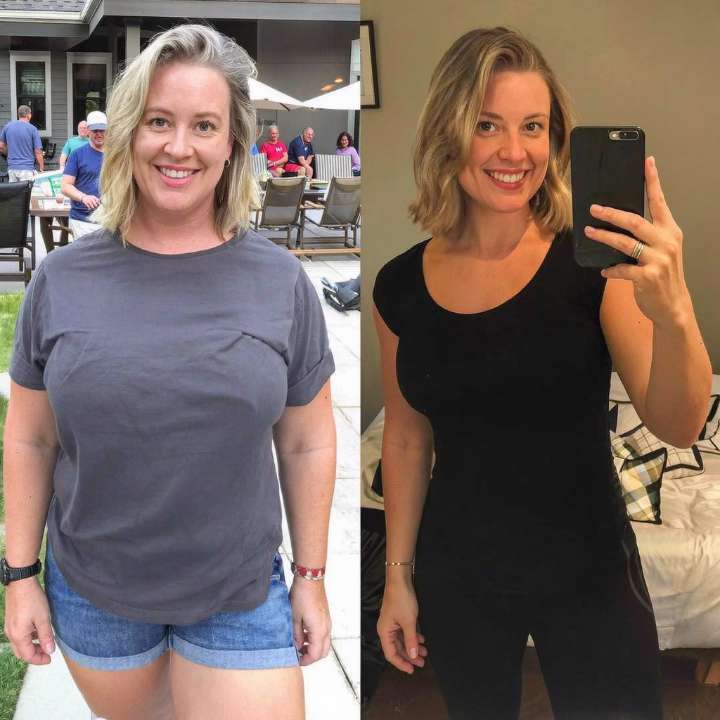 Halden Health patient before and after